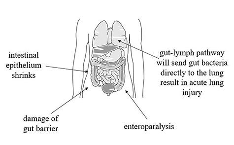 https://cdn.ncbi.nlm.nih.gov/pmc/blobs/8d09/7901705/bd40fe333ef9/tkaa048f1.jpg
