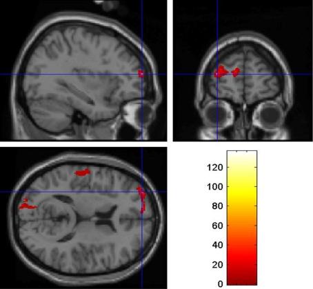 https://cdn.ncbi.nlm.nih.gov/pmc/blobs/8d0b/2965016/93e506904033/fnbeh-04-00160-g001.jpg