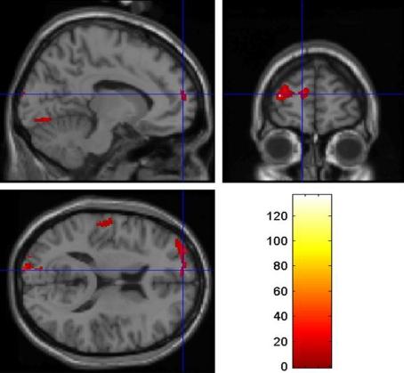 https://cdn.ncbi.nlm.nih.gov/pmc/blobs/8d0b/2965016/c8cd3d448bb7/fnbeh-04-00160-g002.jpg