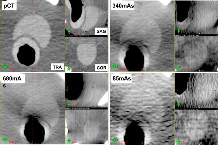 https://cdn.ncbi.nlm.nih.gov/pmc/blobs/8d0e/7592495/38e572717183/bjro.20190028.g006.jpg