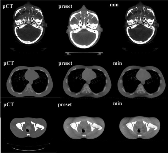 https://cdn.ncbi.nlm.nih.gov/pmc/blobs/8d0e/7592495/d4887016d909/bjro.20190028.g005.jpg