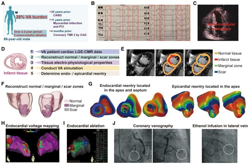 https://cdn.ncbi.nlm.nih.gov/pmc/blobs/8d0f/12396111/b515750b75bf/ytaf384_ga.jpg
