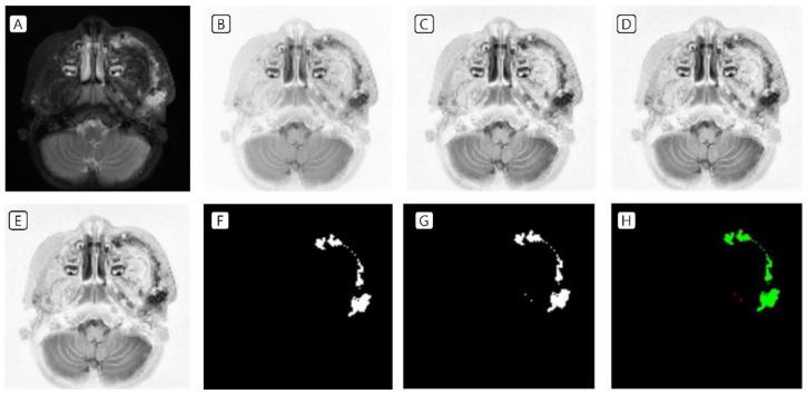 https://cdn.ncbi.nlm.nih.gov/pmc/blobs/8d0f/9573069/65b33be2ba45/jcm-11-05593-g003.jpg