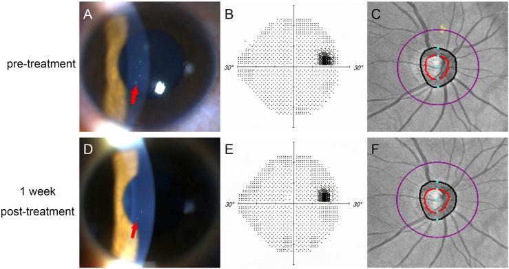 https://cdn.ncbi.nlm.nih.gov/pmc/blobs/8d12/9198647/bf57eca9c598/fphys-13-886871-g001.jpg