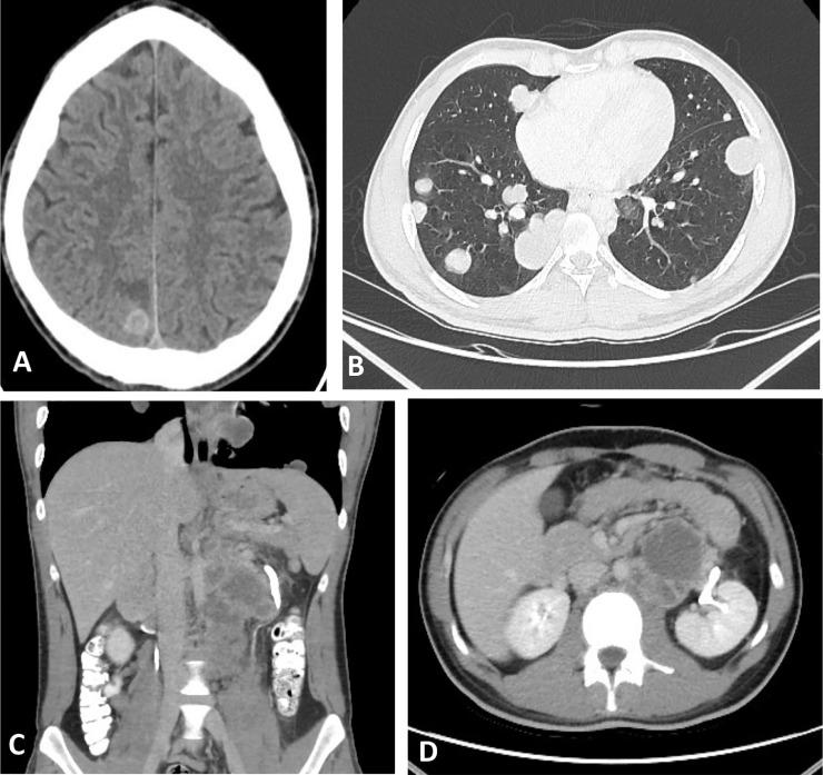https://cdn.ncbi.nlm.nih.gov/pmc/blobs/8d1c/7881168/617a3489a130/gr4.jpg