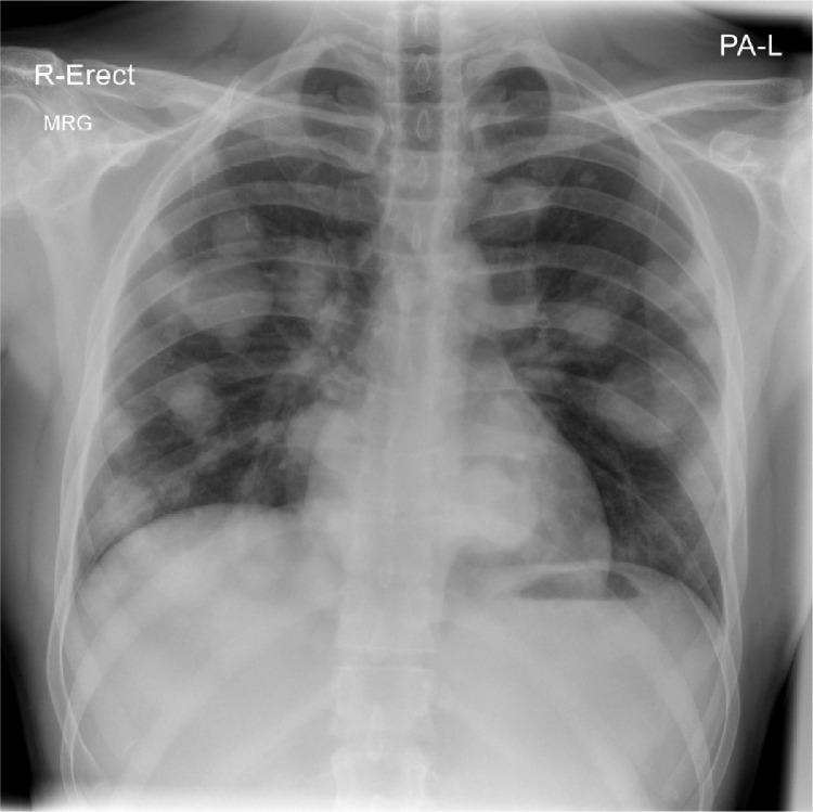 https://cdn.ncbi.nlm.nih.gov/pmc/blobs/8d1c/7881168/afa2afec06ec/gr2.jpg