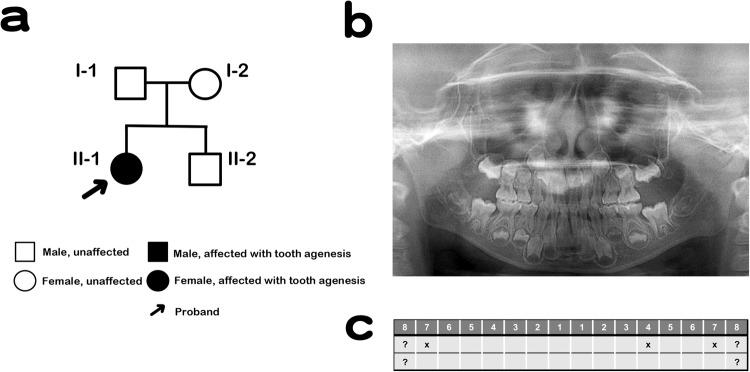https://cdn.ncbi.nlm.nih.gov/pmc/blobs/8d25/10806032/8425843b62fb/41439_2023_259_Fig1_HTML.jpg