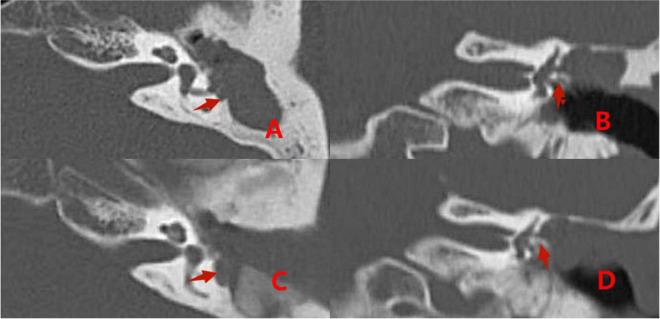 https://cdn.ncbi.nlm.nih.gov/pmc/blobs/8d28/9669453/76e7d396cd9e/fnins-16-1032087-g007.jpg