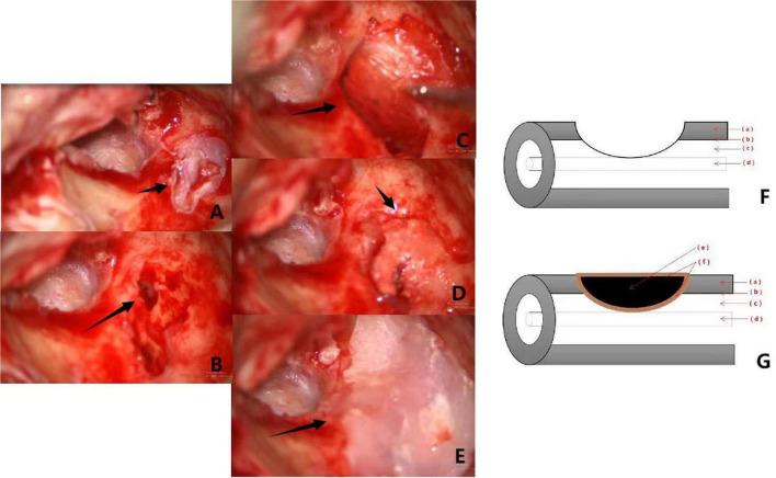 https://cdn.ncbi.nlm.nih.gov/pmc/blobs/8d28/9669453/8309a8dfa92f/fnins-16-1032087-g003.jpg