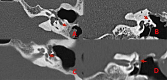 https://cdn.ncbi.nlm.nih.gov/pmc/blobs/8d28/9669453/dac501e71e6d/fnins-16-1032087-g006.jpg