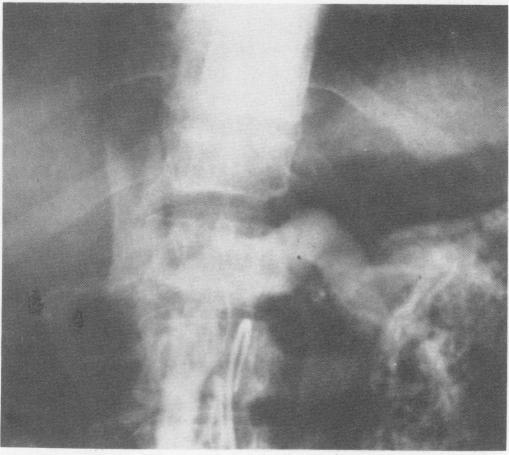 https://cdn.ncbi.nlm.nih.gov/pmc/blobs/8d2f/1345337/8ae136291c8f/annsurg00212-0176-a.jpg