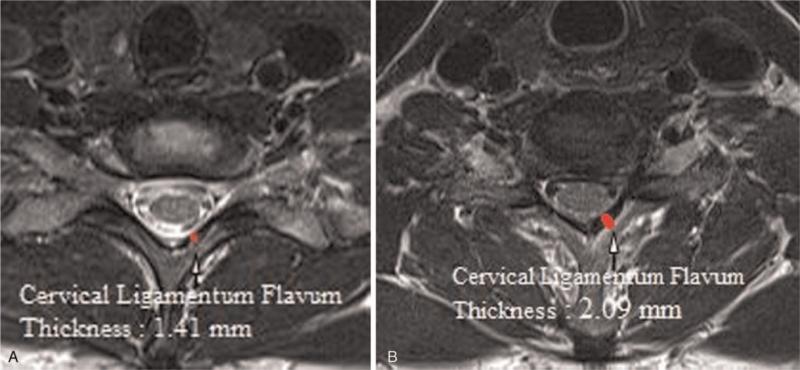 https://cdn.ncbi.nlm.nih.gov/pmc/blobs/8d3a/8389973/d53ac94c8177/medi-100-e27084-g001.jpg