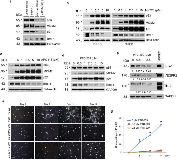 https://cdn.ncbi.nlm.nih.gov/pmc/blobs/8d45/8225874/43bf4e902518/41419_2021_3925_Fig5_HTML.jpg