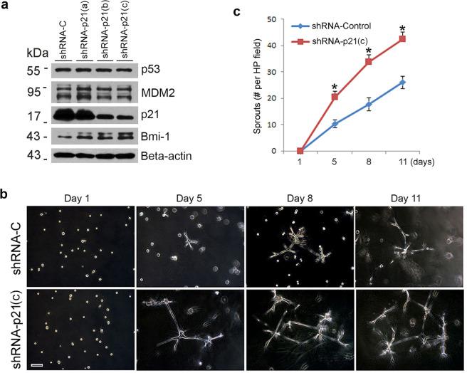 https://cdn.ncbi.nlm.nih.gov/pmc/blobs/8d45/8225874/f50ddfe21565/41419_2021_3925_Fig4_HTML.jpg