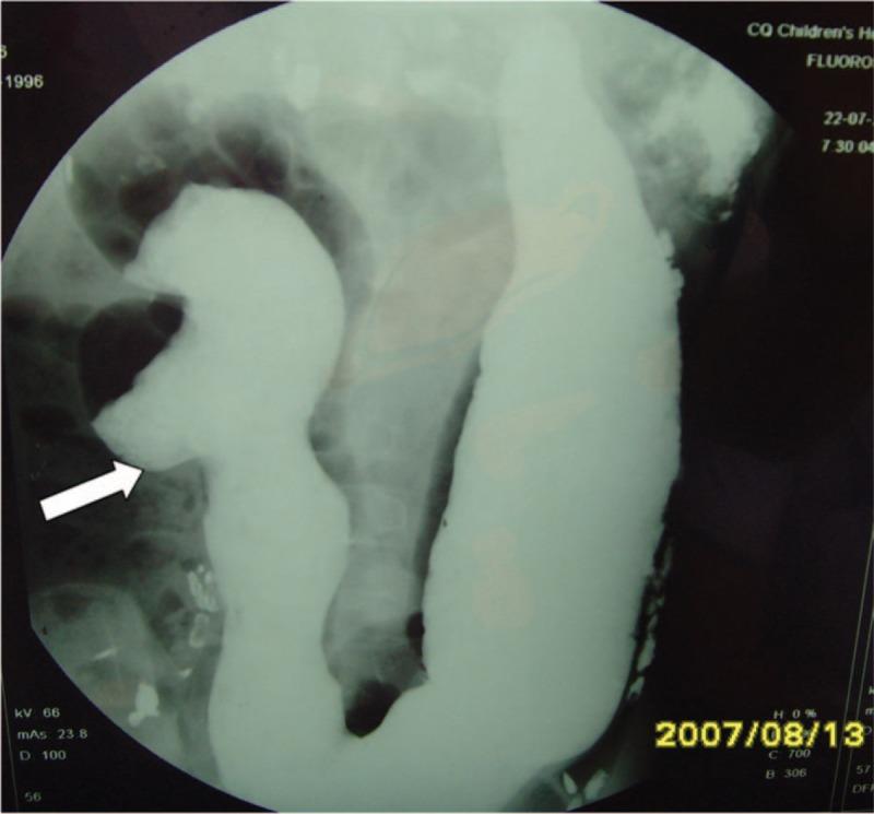 https://cdn.ncbi.nlm.nih.gov/pmc/blobs/8d46/6946480/182e679a3c46/medi-98-e17682-g003.jpg