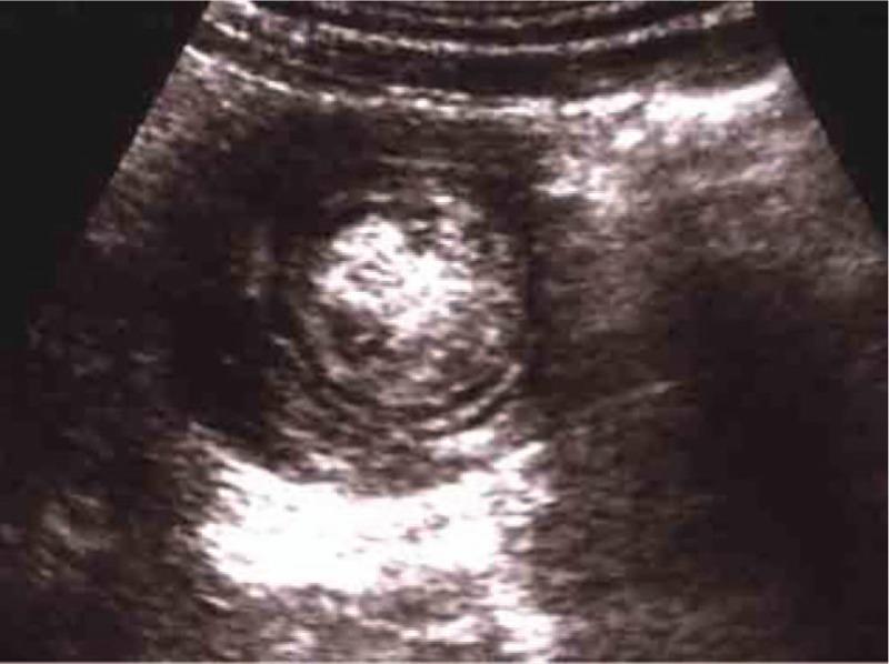 https://cdn.ncbi.nlm.nih.gov/pmc/blobs/8d46/6946480/577ab5ad57b0/medi-98-e17682-g002.jpg