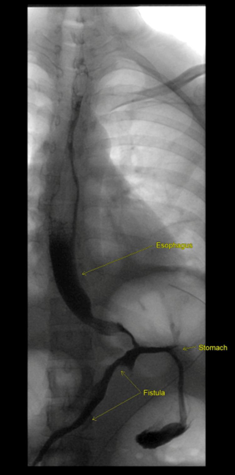 https://cdn.ncbi.nlm.nih.gov/pmc/blobs/8d48/10924469/6435927b19b0/cureus-0016-00000053846-i04.jpg