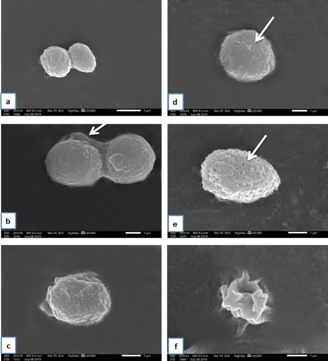 https://cdn.ncbi.nlm.nih.gov/pmc/blobs/8d48/8071969/264bd8f55dfa/gr7.jpg