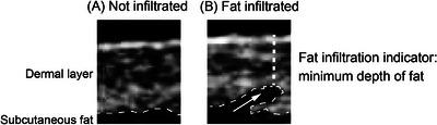 https://cdn.ncbi.nlm.nih.gov/pmc/blobs/8d4d/10155789/b82504b3925e/SRT-29-e13296-g005.jpg