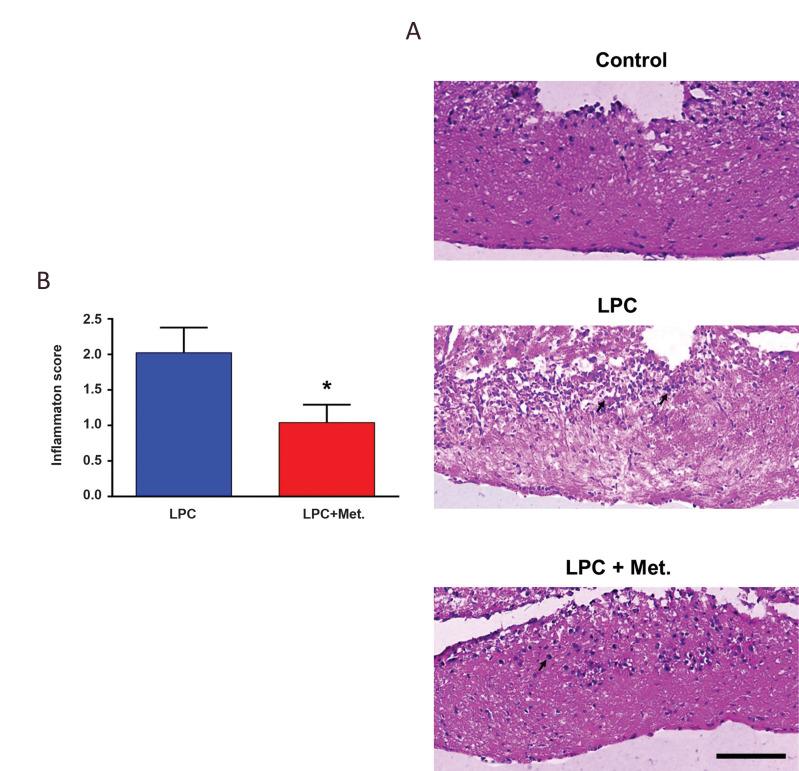 https://cdn.ncbi.nlm.nih.gov/pmc/blobs/8d56/7944130/83425b1c352f/Cell-J-23-119-g03.jpg