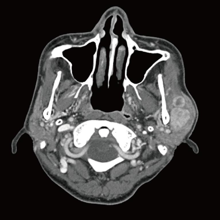 https://cdn.ncbi.nlm.nih.gov/pmc/blobs/8d59/4738114/d193a50c259e/aps-43-107-g001.jpg