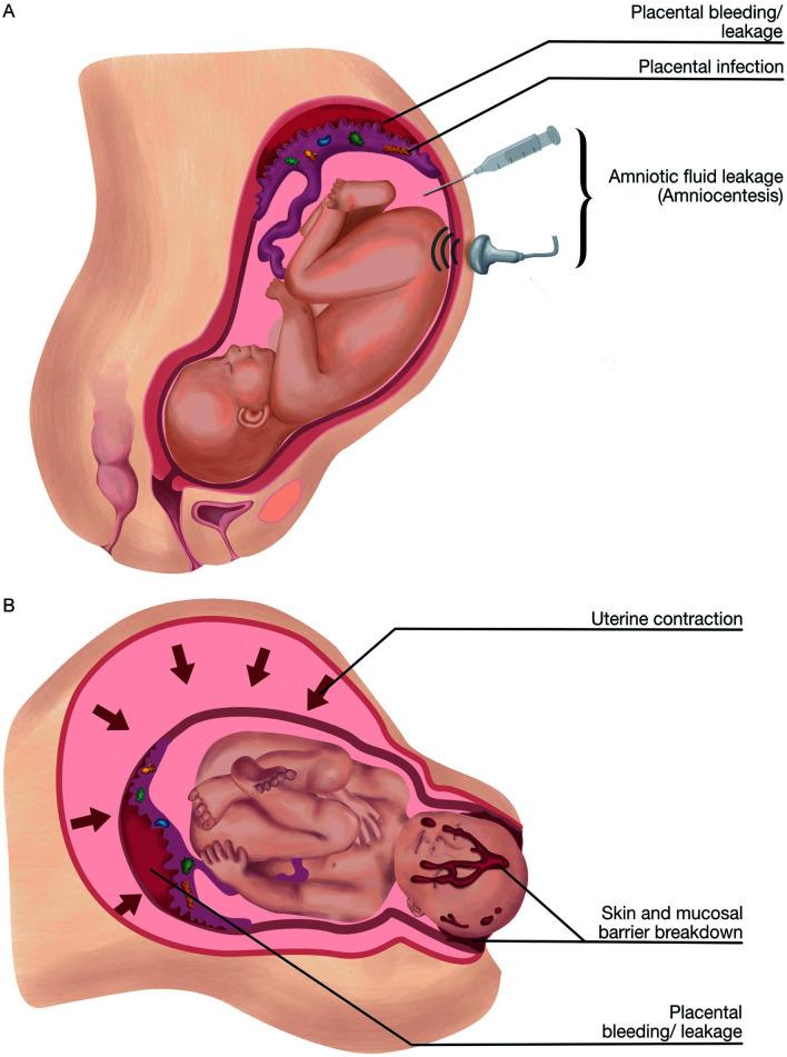 https://cdn.ncbi.nlm.nih.gov/pmc/blobs/8d5b/10318275/3ab603fda7f2/JCTH-11-967-g002.jpg