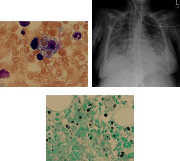 https://cdn.ncbi.nlm.nih.gov/pmc/blobs/8d5e/7847327/53120d267e58/CRICC2021-6612710.001.jpg
