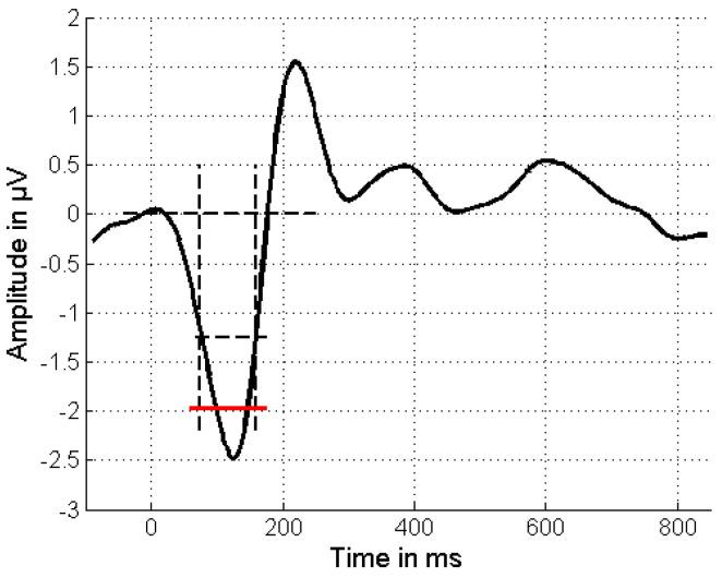 https://cdn.ncbi.nlm.nih.gov/pmc/blobs/8d61/12024420/91e2cac5c288/audiolres-15-00043-g001.jpg