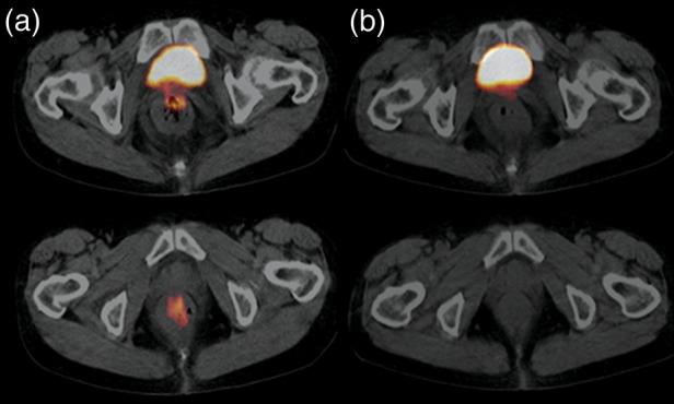 https://cdn.ncbi.nlm.nih.gov/pmc/blobs/8d62/3823770/8c1fe00c7679/rrt03303.jpg