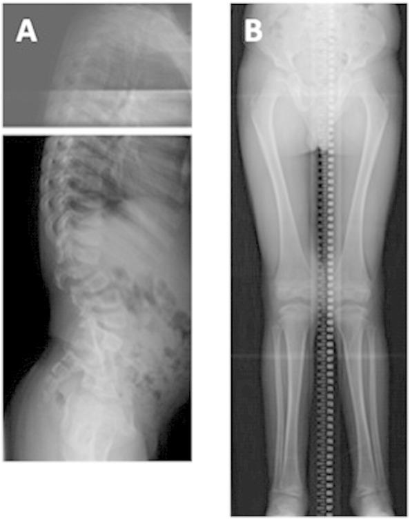 https://cdn.ncbi.nlm.nih.gov/pmc/blobs/8d62/4863258/e9891033b735/gr1.jpg