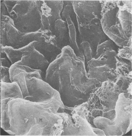 https://cdn.ncbi.nlm.nih.gov/pmc/blobs/8d63/422299/3c896c3cf30a/iai00195-0331-a.jpg