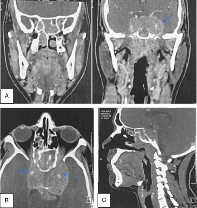 https://cdn.ncbi.nlm.nih.gov/pmc/blobs/8d6a/10205378/c63deb346239/ms9-85-2029-g001.jpg