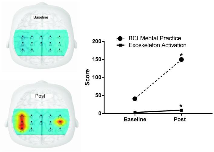 https://cdn.ncbi.nlm.nih.gov/pmc/blobs/8d6f/9869053/266b73af870b/fneur-13-1041978-g0004.jpg