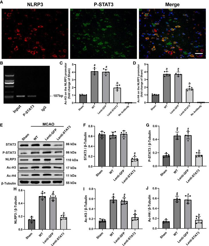 https://cdn.ncbi.nlm.nih.gov/pmc/blobs/8d75/8339584/bee8ab7b5689/fimmu-12-714943-g009.jpg