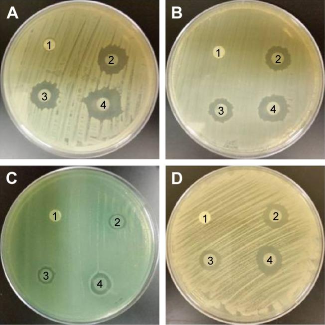 https://cdn.ncbi.nlm.nih.gov/pmc/blobs/8d7a/5367563/edba6e788c70/ijn-12-2205Fig8.jpg