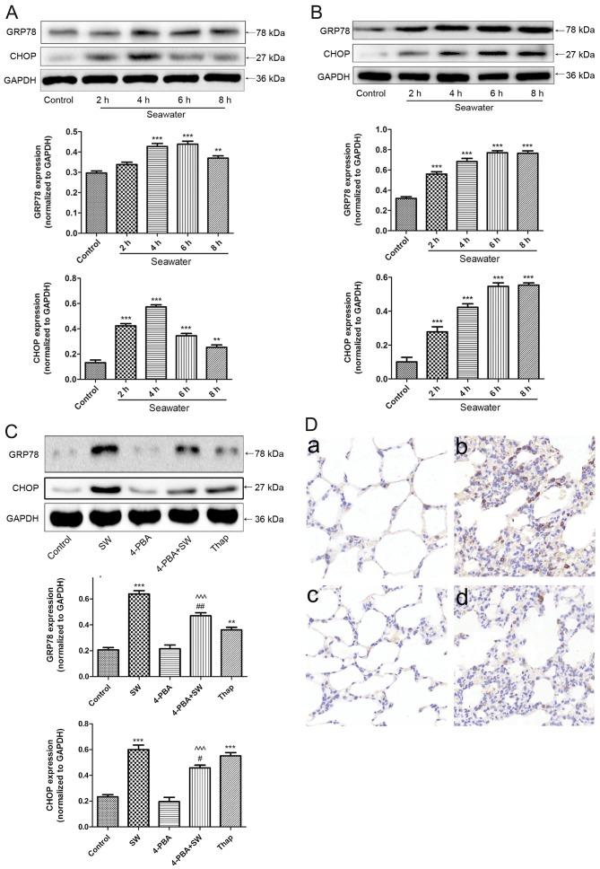 https://cdn.ncbi.nlm.nih.gov/pmc/blobs/8d82/5846659/b31a640fe79a/IJMM-41-05-2505-g04.jpg