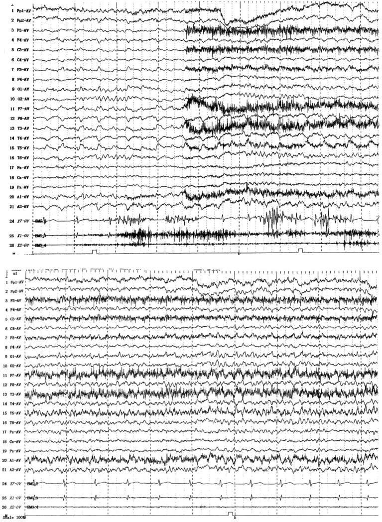 https://cdn.ncbi.nlm.nih.gov/pmc/blobs/8d84/12283666/0277e29f6798/fnhum-19-1585730-g002.jpg