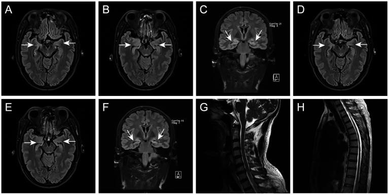 https://cdn.ncbi.nlm.nih.gov/pmc/blobs/8d84/12283666/5df554f4770e/fnhum-19-1585730-g001.jpg