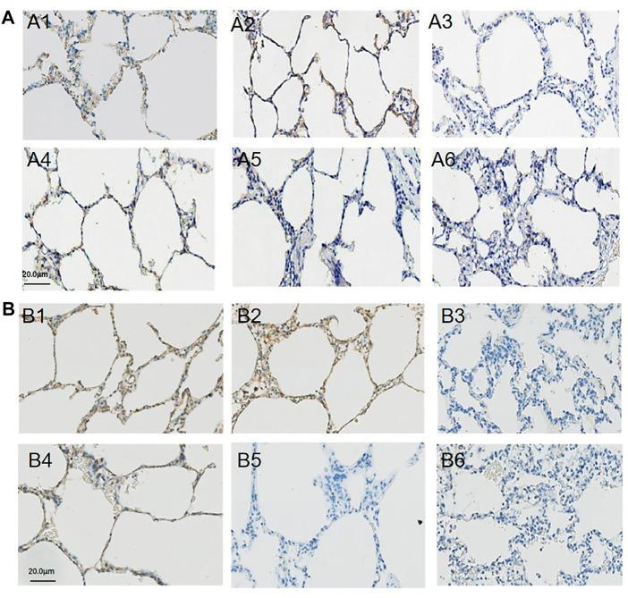 https://cdn.ncbi.nlm.nih.gov/pmc/blobs/8d91/9354663/cf4659e93a95/fphys-13-927507-g004.jpg