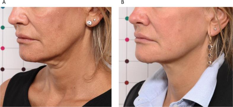 https://cdn.ncbi.nlm.nih.gov/pmc/blobs/8d93/11754354/579804632c92/10103_2024_4270_Fig2_HTML.jpg