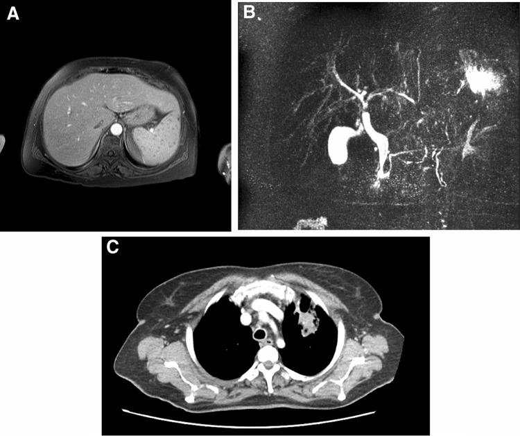 https://cdn.ncbi.nlm.nih.gov/pmc/blobs/8d9a/5408327/746118a62453/13317_2017_94_Fig1_HTML.jpg