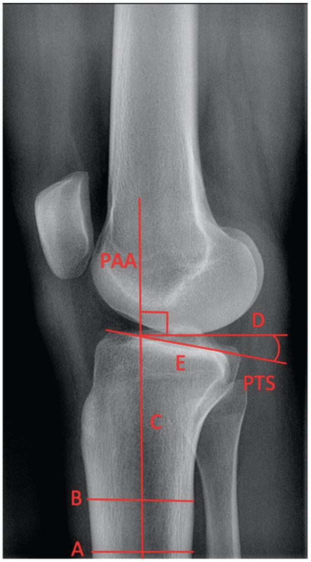 https://cdn.ncbi.nlm.nih.gov/pmc/blobs/8da2/8739589/2b5a1869b8c8/10.1177_03635465211054100-fig2.jpg