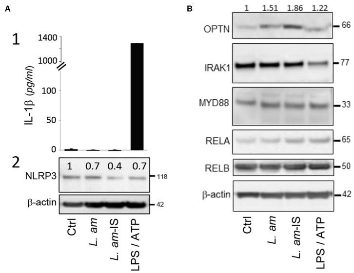 https://cdn.ncbi.nlm.nih.gov/pmc/blobs/8da4/7295916/cc87b7384abf/fimmu-11-01098-g0002.jpg