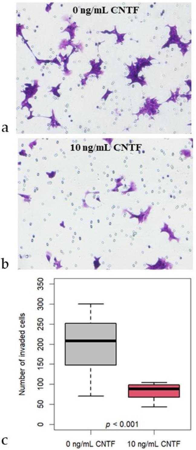 https://cdn.ncbi.nlm.nih.gov/pmc/blobs/8da6/9739171/0edf8c4db5a5/cancers-14-05917-g007.jpg