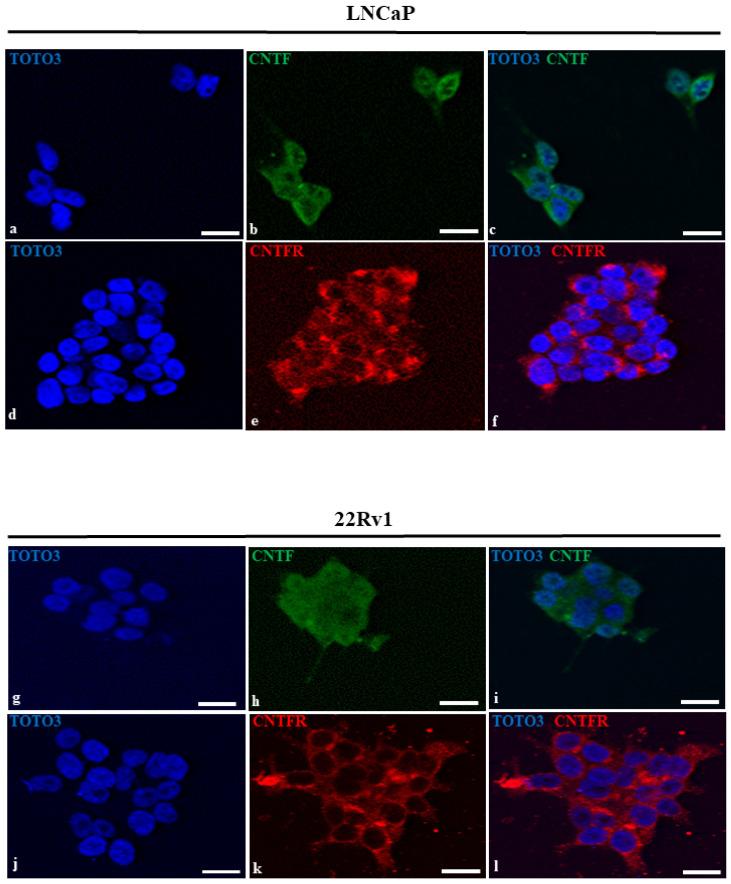 https://cdn.ncbi.nlm.nih.gov/pmc/blobs/8da6/9739171/f902084976f9/cancers-14-05917-g002.jpg
