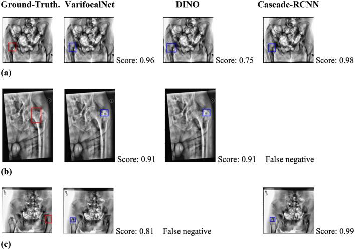 https://cdn.ncbi.nlm.nih.gov/pmc/blobs/8da9/11130146/55fc1157894b/41598_2024_63001_Fig3_HTML.jpg