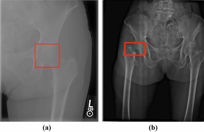 https://cdn.ncbi.nlm.nih.gov/pmc/blobs/8da9/11130146/74163bb2339a/41598_2024_63001_Fig4_HTML.jpg