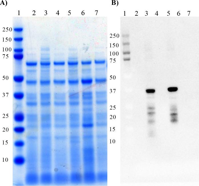 https://cdn.ncbi.nlm.nih.gov/pmc/blobs/8dad/8168883/e27c3f652543/pone.0252214.g003.jpg