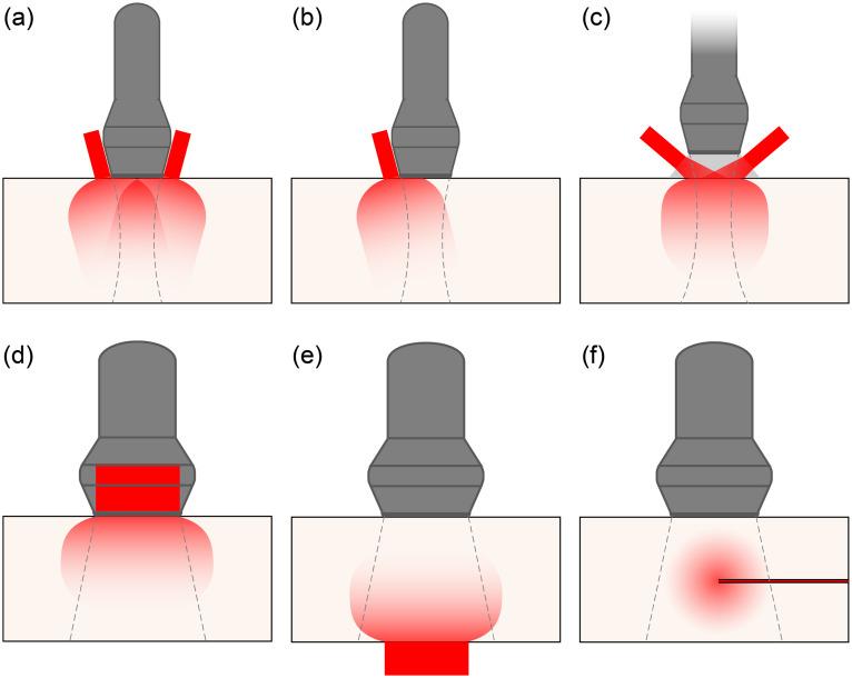 https://cdn.ncbi.nlm.nih.gov/pmc/blobs/8dc0/10249868/d194b8b9ea84/JBO-028-121205-g010.jpg