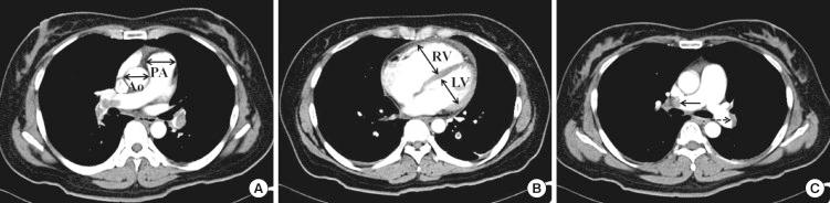 https://cdn.ncbi.nlm.nih.gov/pmc/blobs/8dc0/3492669/f83c32a2fde2/jkms-27-1347-g001.jpg